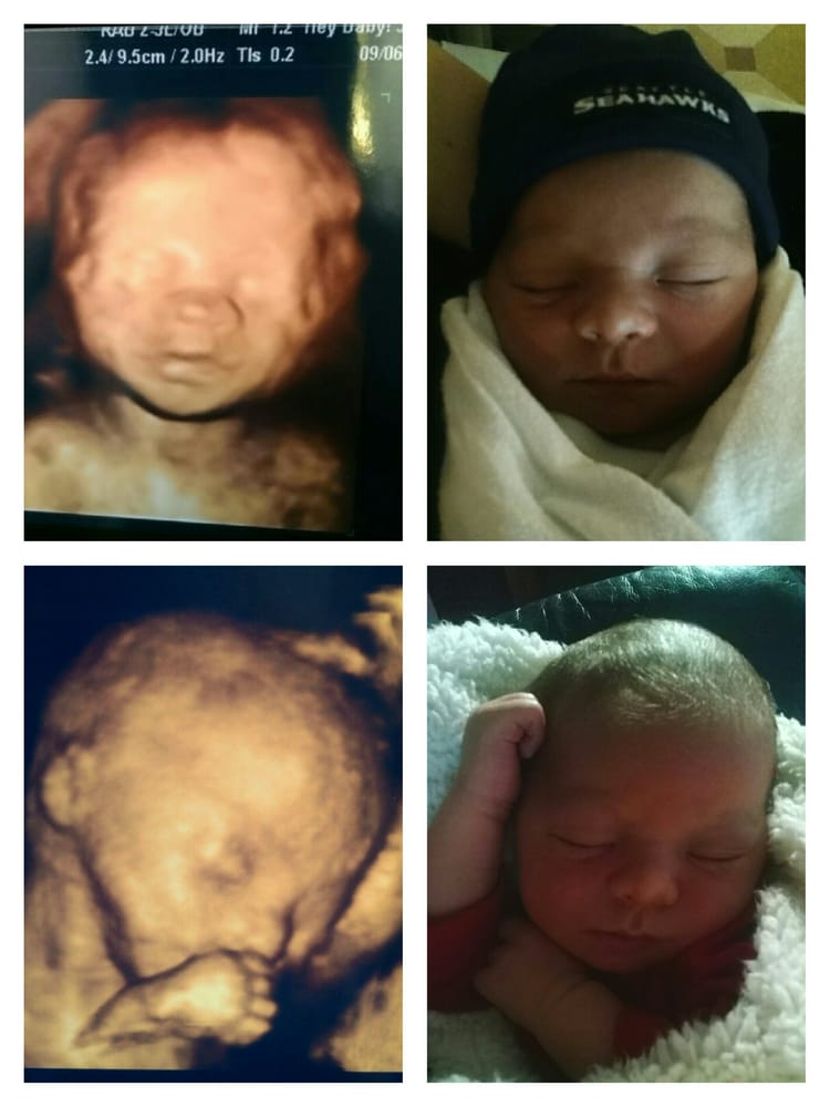 2 months dating and pregnant This month-by-month guide to pregnancy may help you plan for some of the changes that may occur. 2 months dating and pregnant This month-by-month guide to pregnancy may help you plan for some of the changes that may occur.