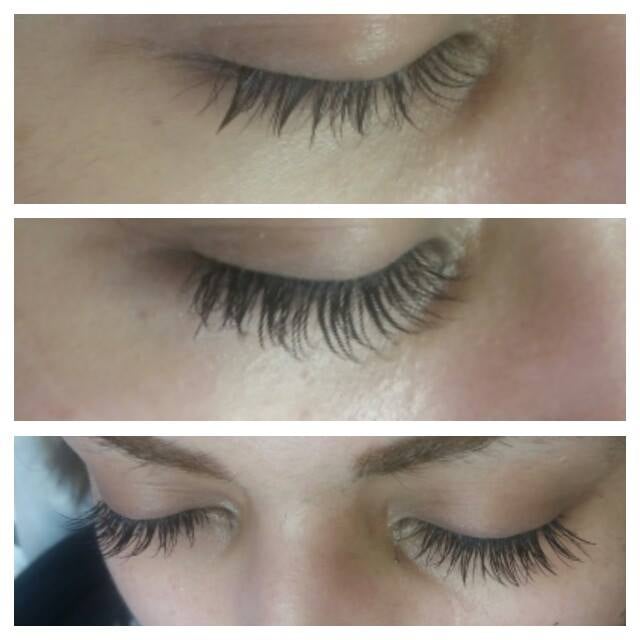 Mila Laser Clinic