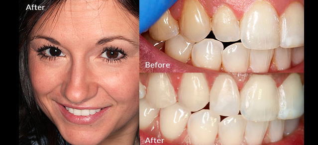 Brush & Floss Dental Center