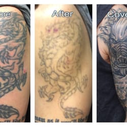 disappearing ink tattoo removal 106 nelbon ave pittsburgh pa disappearing ink tattoo removal 106 nelbon ave pittsburgh pa