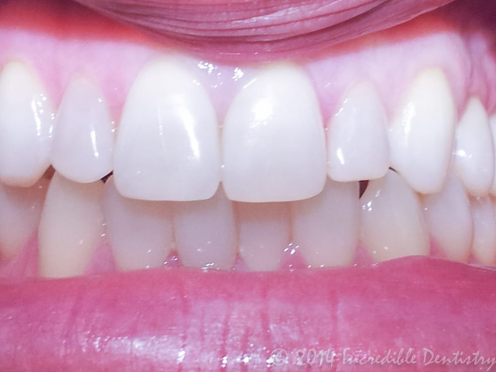 image of business Incredible Dentistry