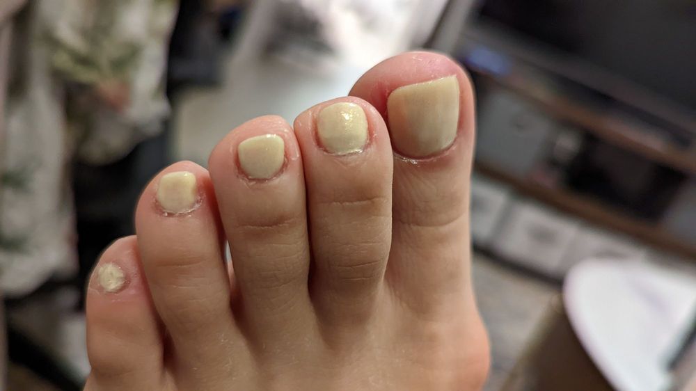 Top A Nail 