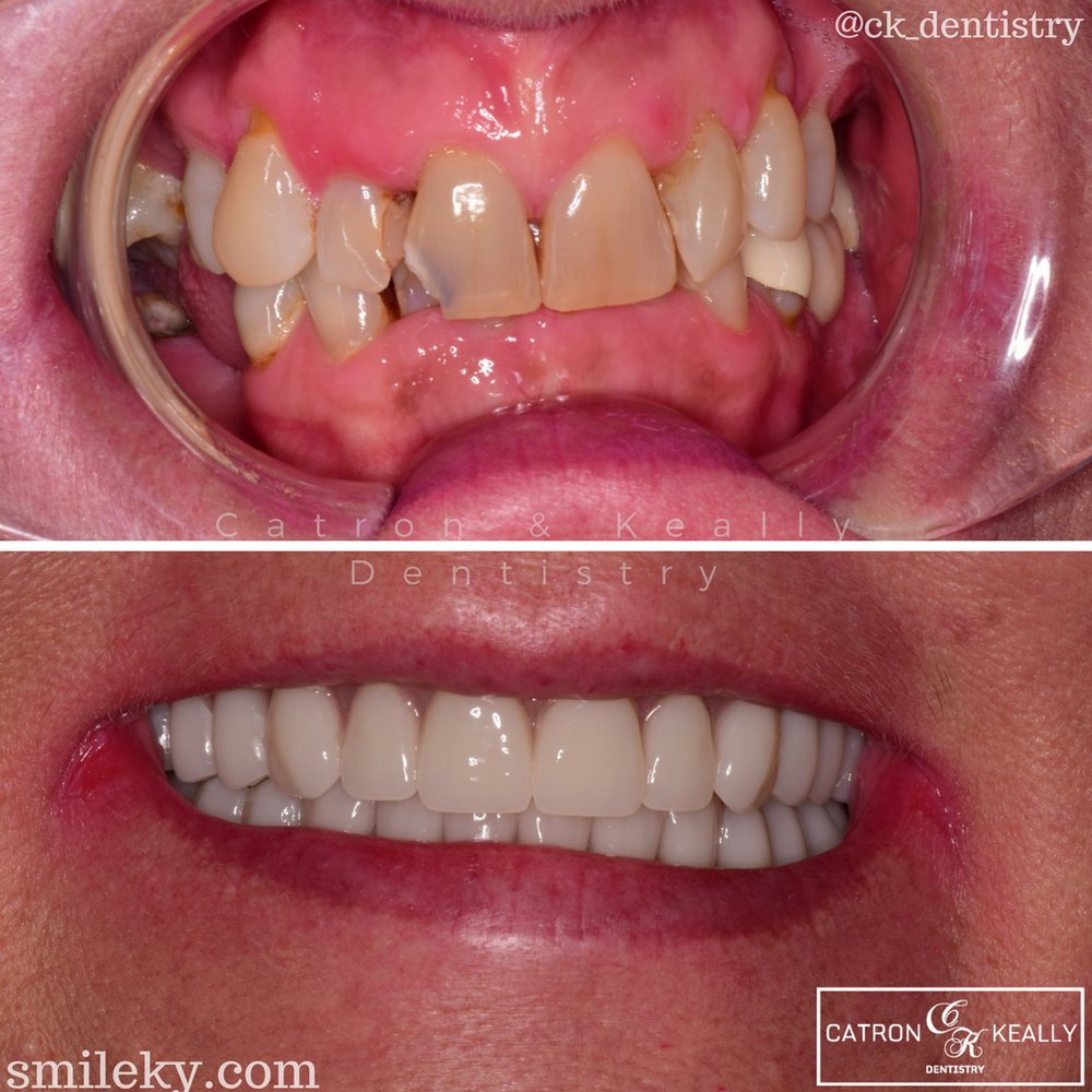 image of business Catron & Keally Dentistry
