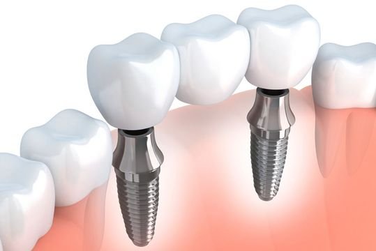 image of business Implant Dental