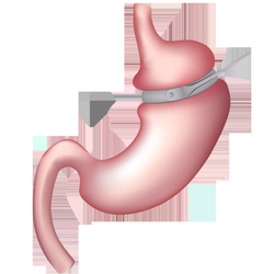 Garcinia cambogia for stomach fat image 8