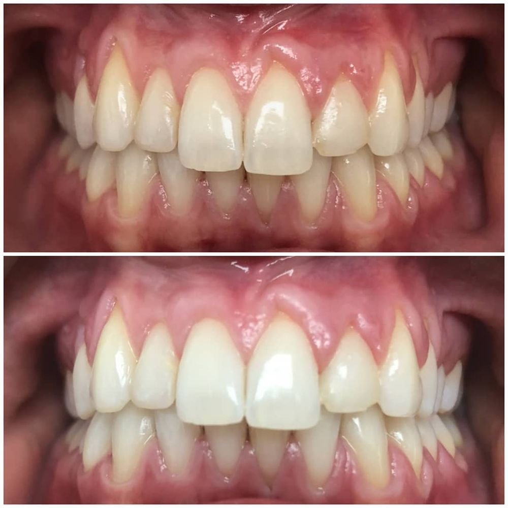 image of business Neil S. Stearns, DMD, Bruce G. Freund, DDS - A Dental365 Company
