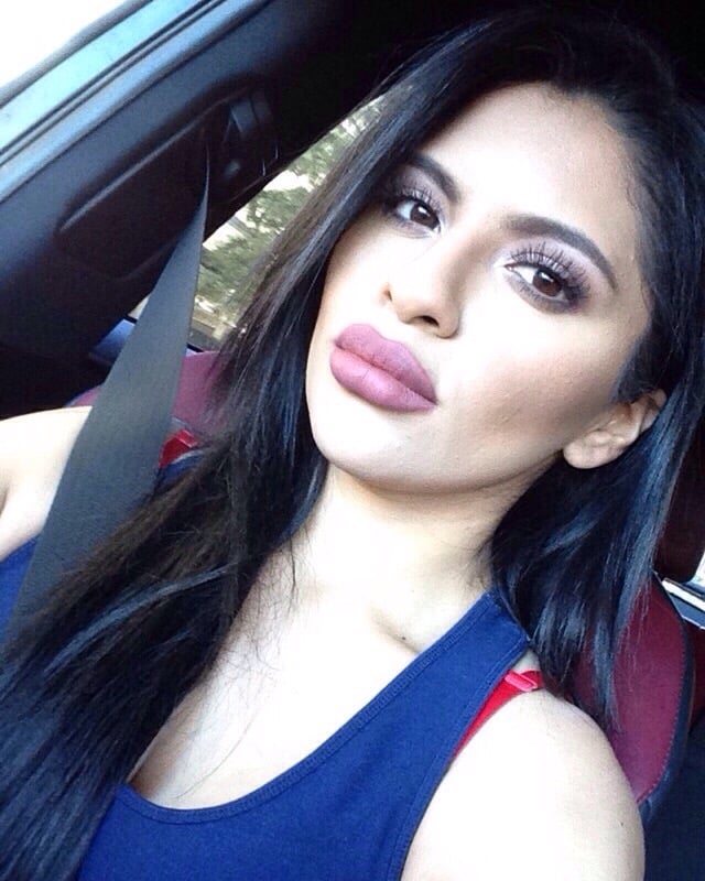 dr lacombe corrected my lumpy lips b4 work done by another dr can