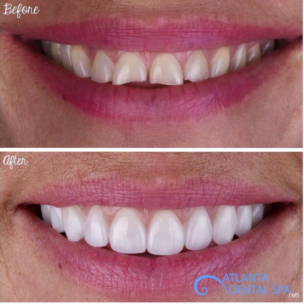 image of business Atlanta Dental Spa