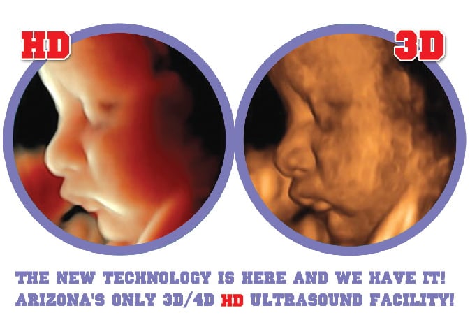 3d vs 4d baby ultrasound