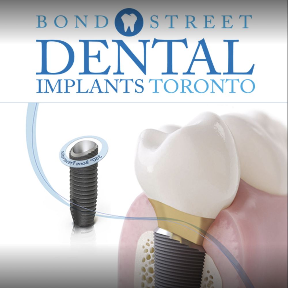 Bond Street Dental Implants