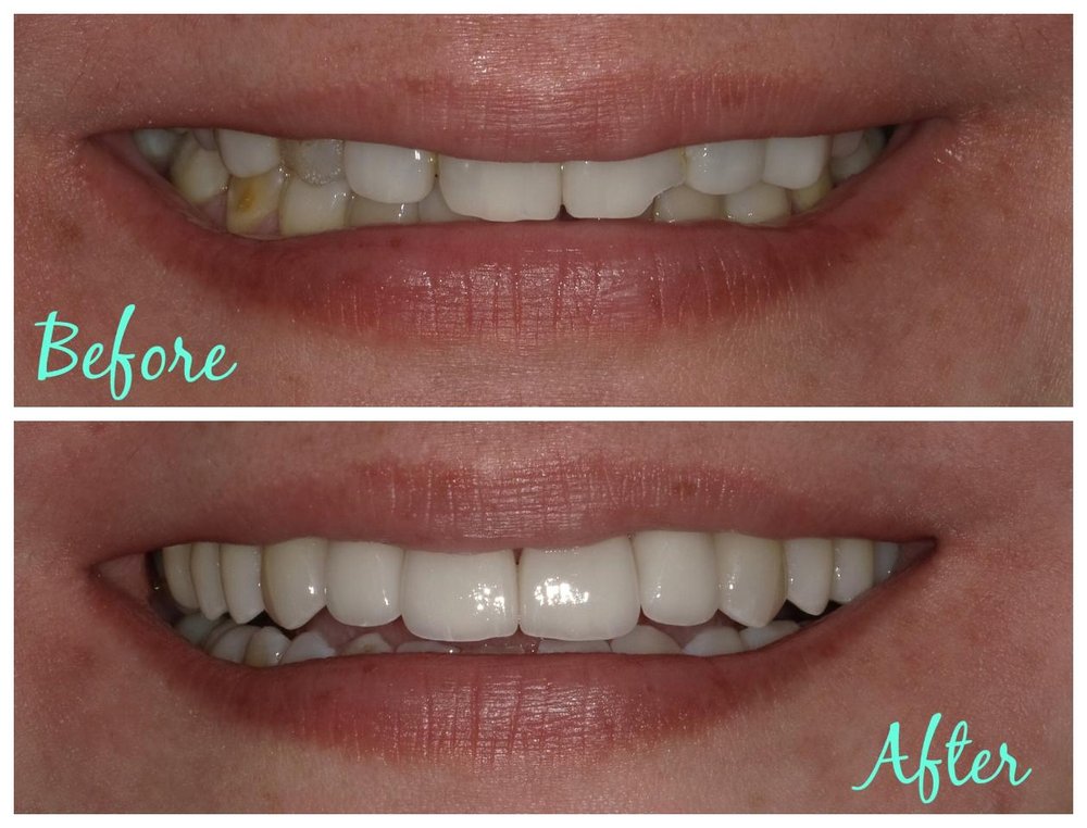 image of business Forest Avenue Dental: Dr. Gary Walker, DDS