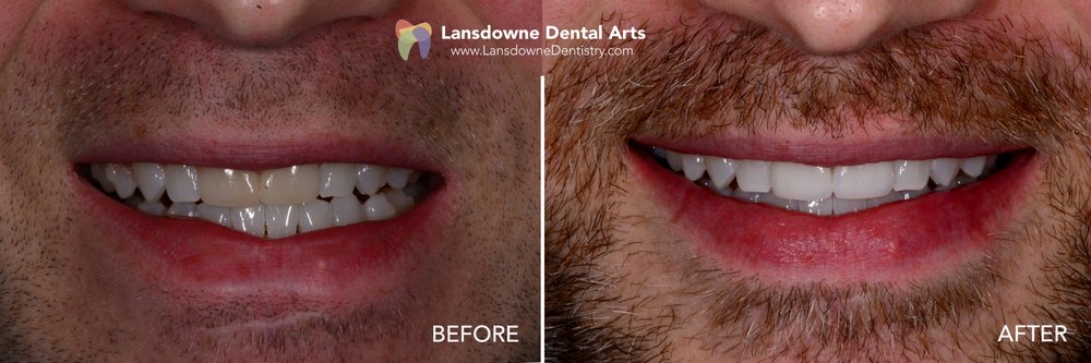 Lansdowne Dental Arts: Jun Chung, DMD