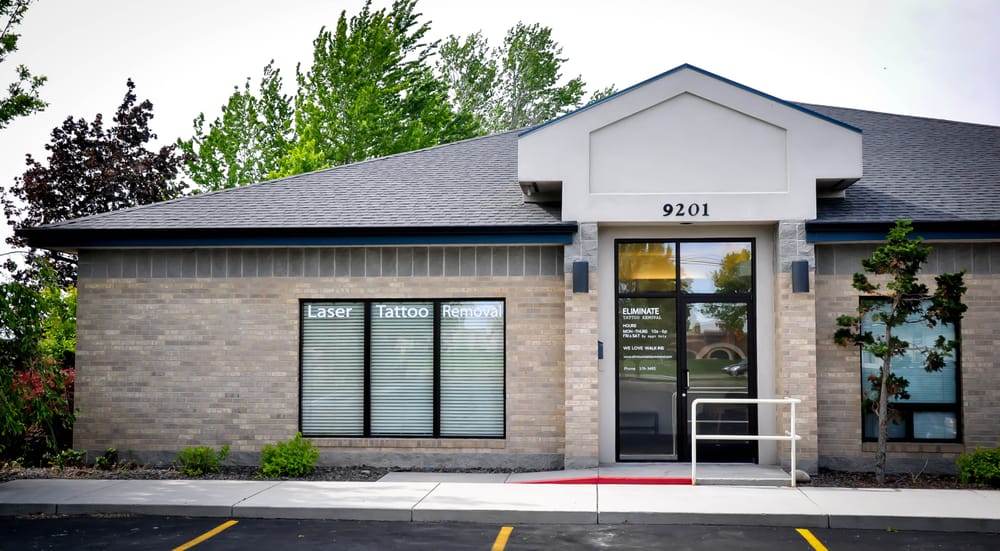 Eliminate Tattoo Removal - Tattoo Removal - 909 S Allante 