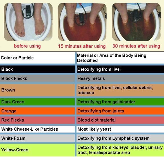 Detox Ionic Foot Bath And Chart Yelp Photo Of Advance Detox Center Rancho Cucamonga Ca United States Ionic