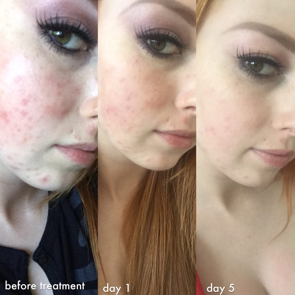 beverly hills dermatology consultants