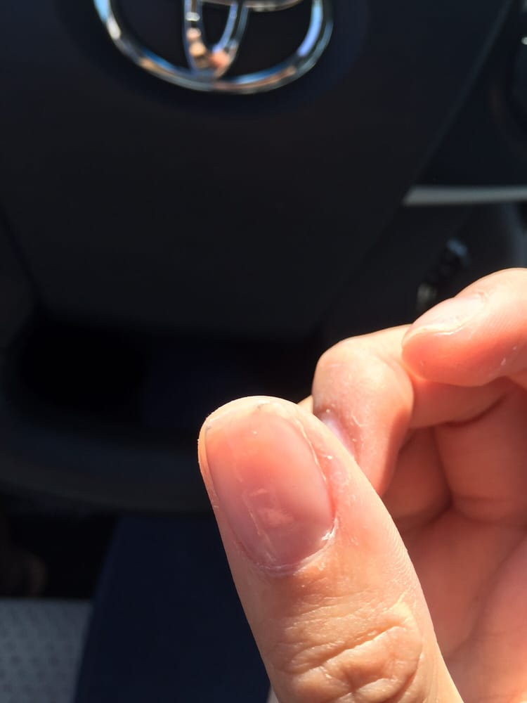 Cut way too much skin - Yelp