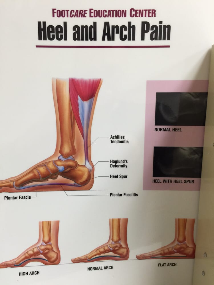 Broadway Foot and Ankle Clinic 17 Reviews Podiatrists 3508 NE