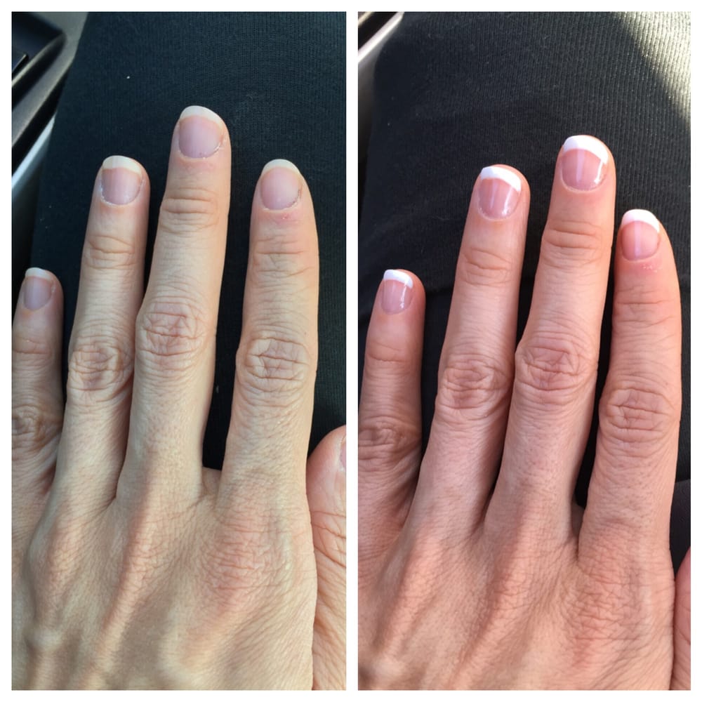 Before And After Shellac French Manicure Yelp Photo Of Heavenly Nails Lynnwood Wa United States Before And After Shellac