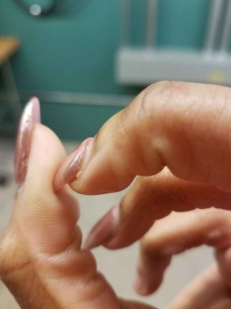 O