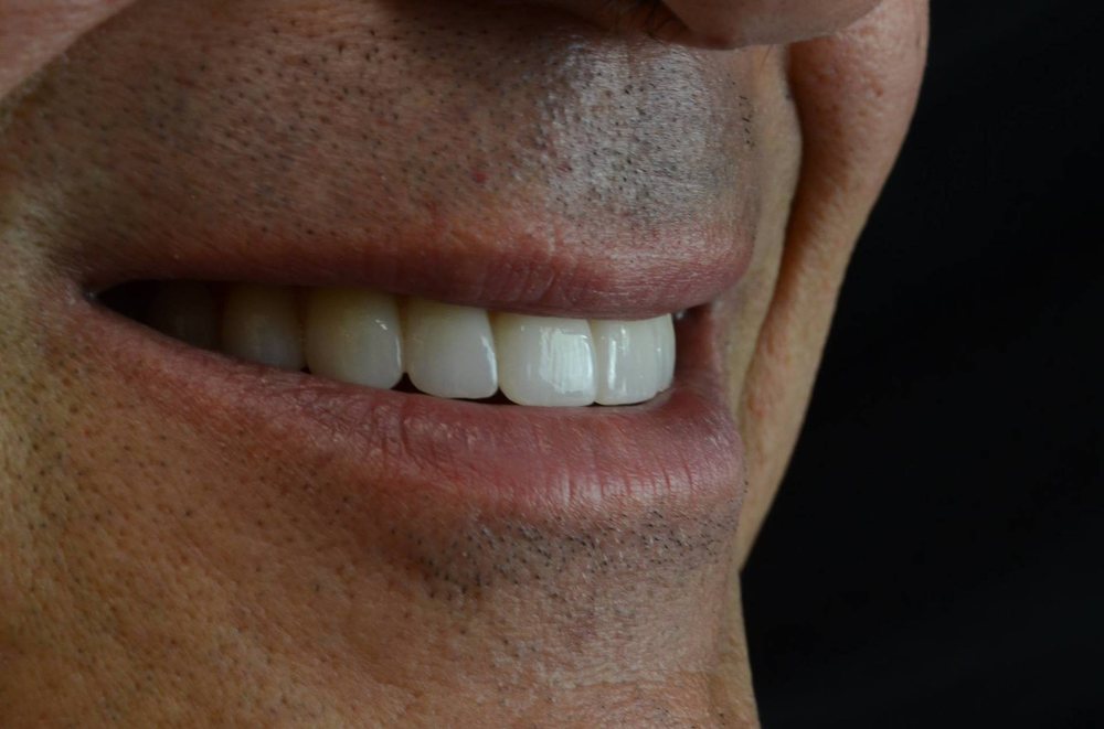 Kozy Dental Care 16 Photos Cosmetic Dentists 3349 Executive