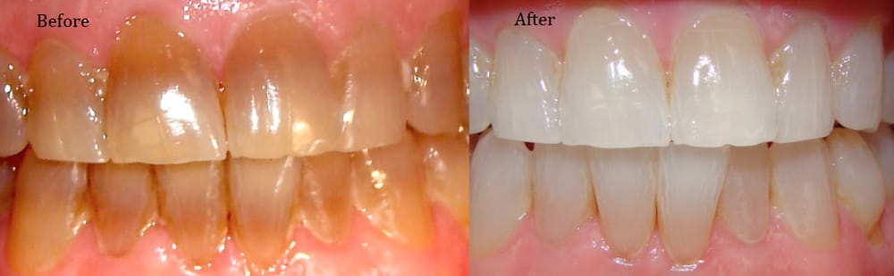 image of business Josephsen Family Dentistry