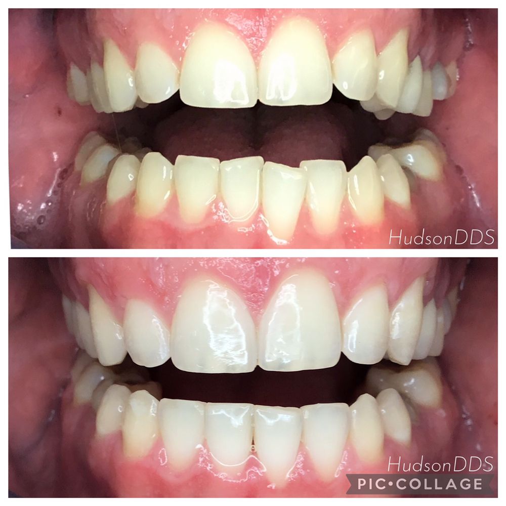 image of business Hudson Dental