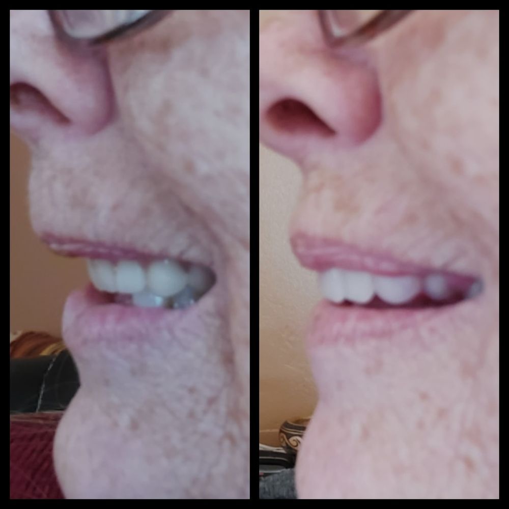 image of business Affordable Dentures