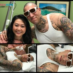 newhope laser skin care 202 photos u0026 77 reviews tattoo removal newhope laser skin care 202 photos u0026 77 reviews tattoo removal