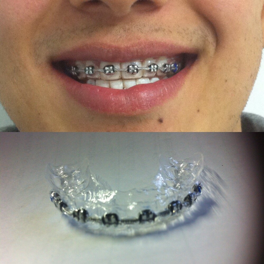 Brackets con Estilo Orthodontists Calle Aurelio L. Gallardo 229