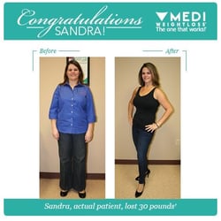 Lose weight after getting wisdom teeth removed photo 4