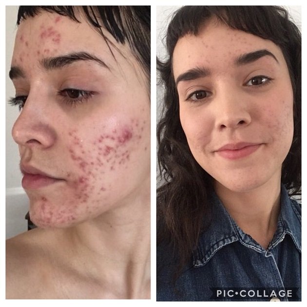 Advanced Skin Care Solutions Image