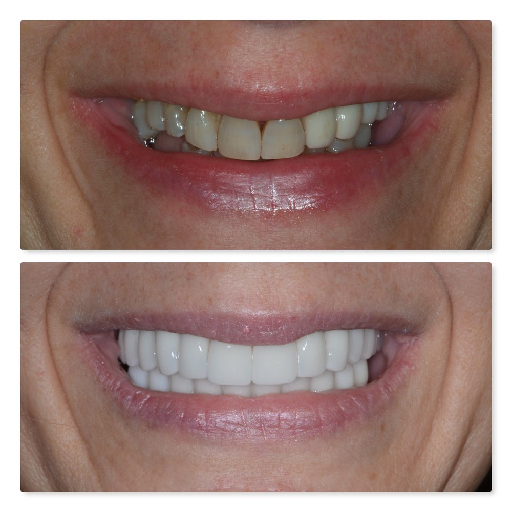 image of business Tarpon Shore Dental - St. Armands