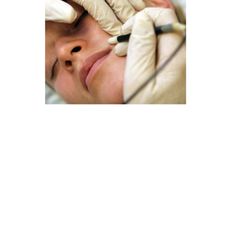 Sherry Giermanski Electrologist LLC dba Unwanted Hair Solutions photo