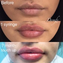 DermFx - 46 Photos & 48 Reviews - Cosmetic Surgeons - 2430 ...