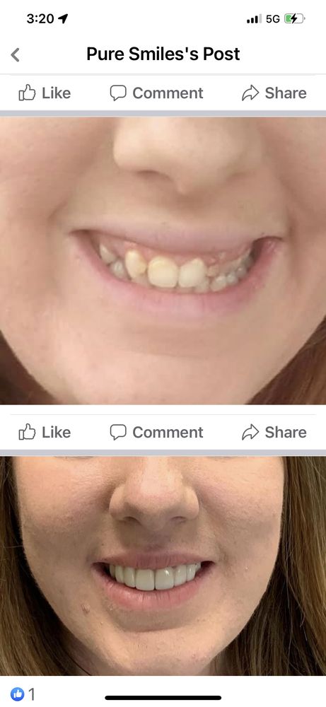 image of business Pure Smiles