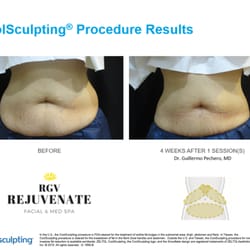 Loss Weight Reno Nv Loss weight reno nv