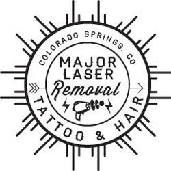 major laser removal tattoo removal 2130 vickers dr colorado major laser removal tattoo removal 2130 vickers dr colorado