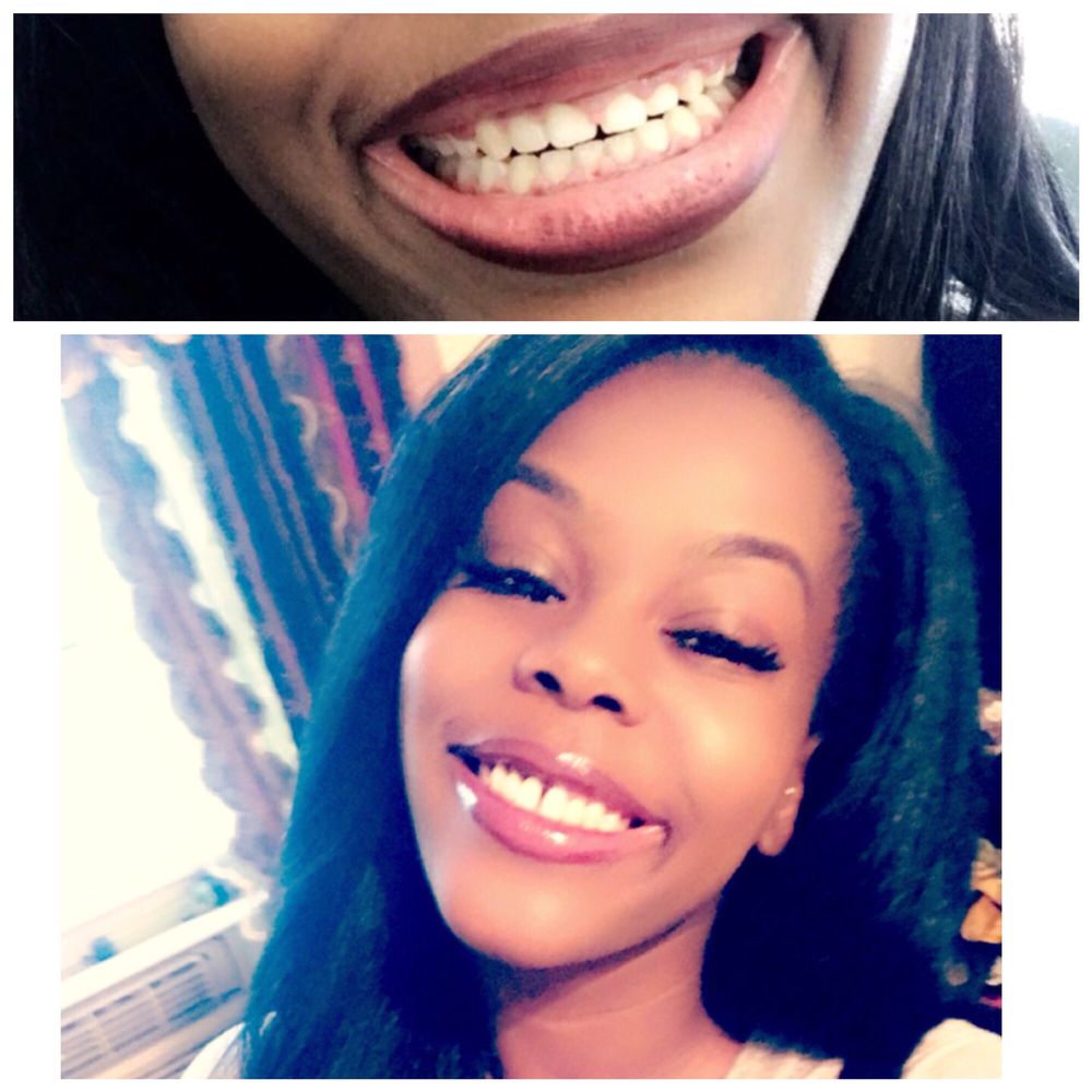 NYC Smile Spa