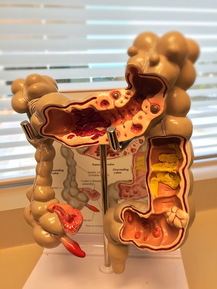 Austin Gastroenterology 22 Reviews Gastroenterologist 1401