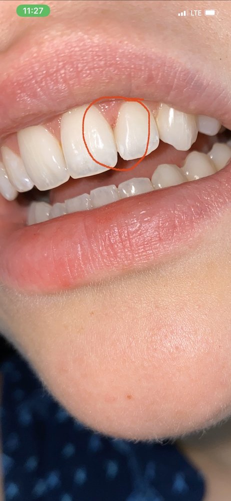 New Smile Dentistry
