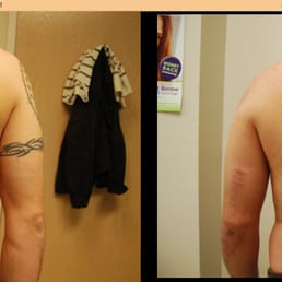 midwest tattoo removal 17 photos tattoo removal 230 center midwest tattoo removal 17 photos tattoo removal 230 center