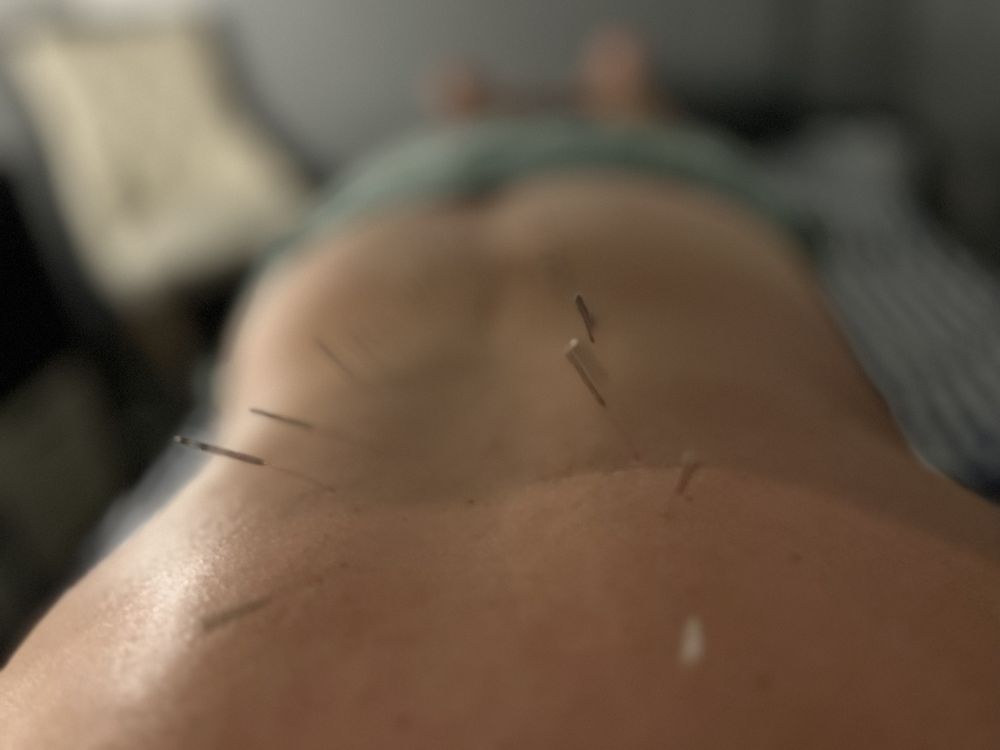 White Crane Acupuncture Clinic