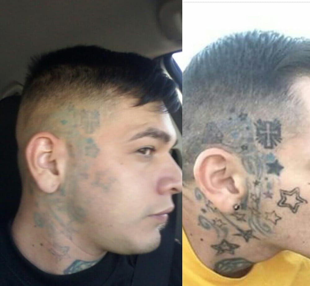 Cleanslate - 14 Photos - Tattoo Removal - 22150 Wardham 