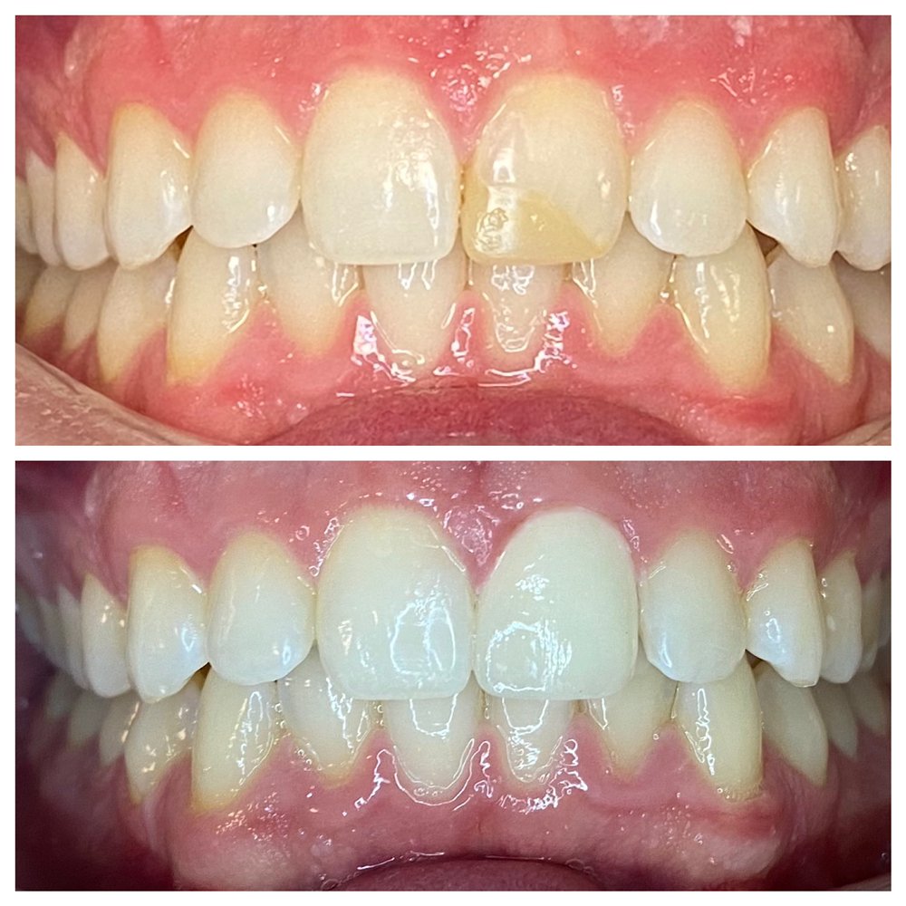 image of business Phuong K Tran, DDS - New Leaf Dentistry