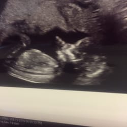 ultrasounds orlando