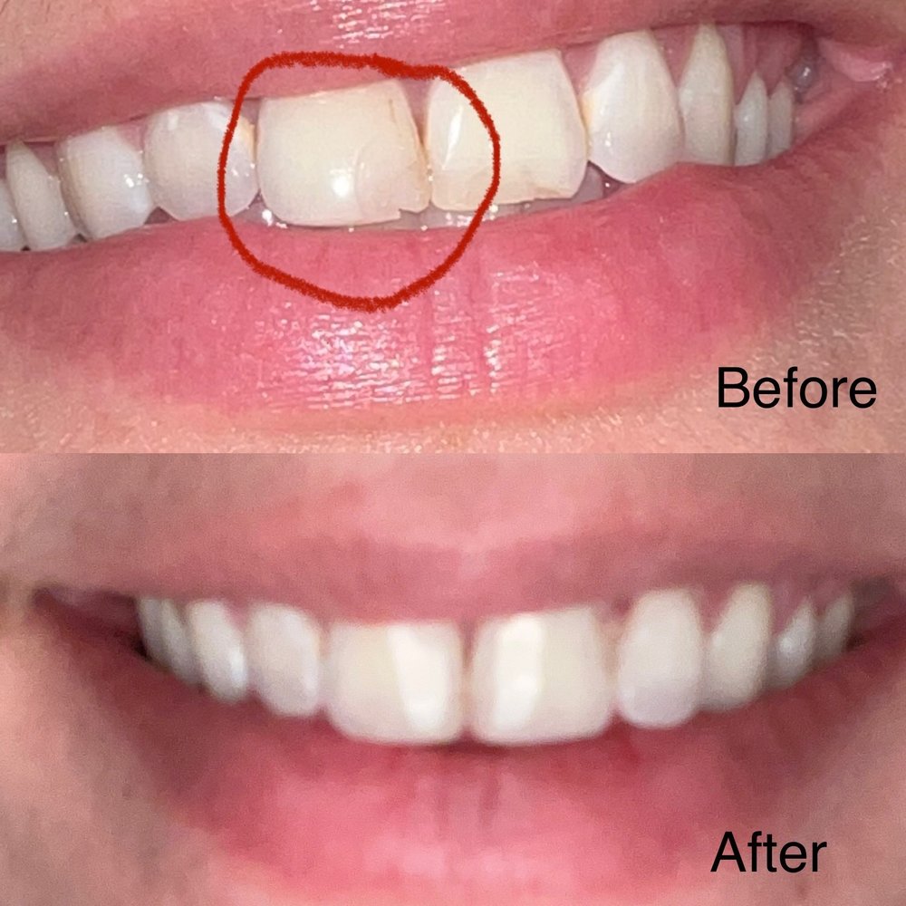 image of business Huntington Dental Excellence