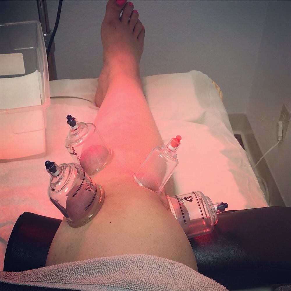 image of business Meditree Acupuncture Clinic