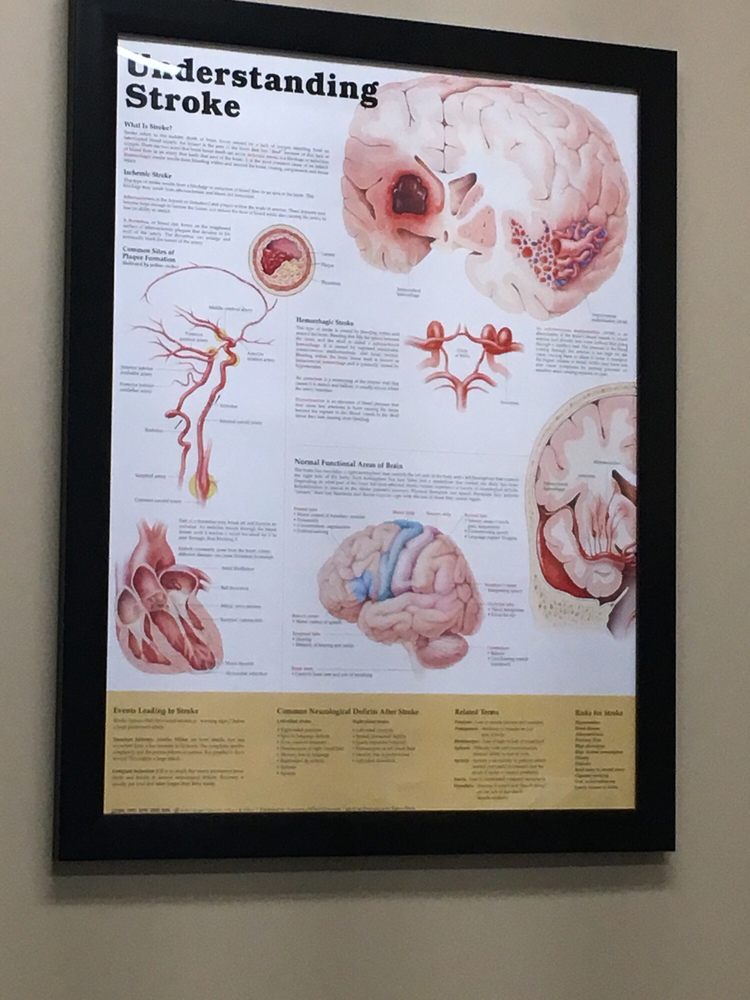 Mather Neurology