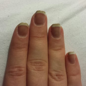 Nail Polish Turns Nails Black Crossfithpu Nail Polish Turns Nails Black Crossfithpu