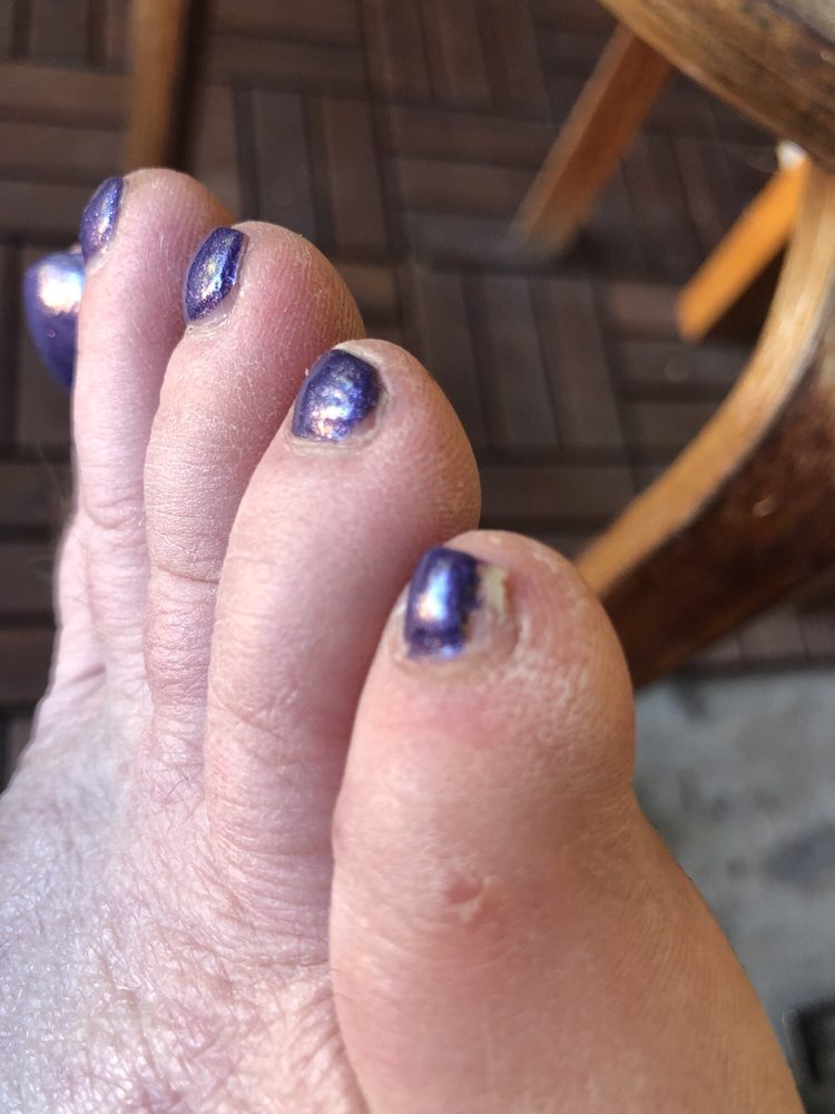 O